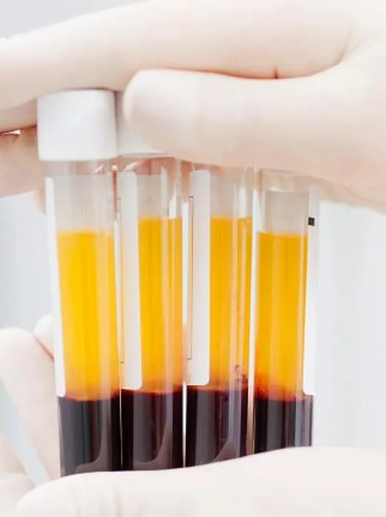 Tubos con plasma separado, rico en factores de crecimiento
